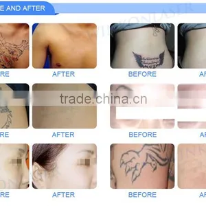Wholesale Portable Tattoo Removal E-light Ipl Rf+nd Yag Laser Multifunction Machine for Skin Care thumbnail-6