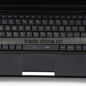 Lower Price Mini Laptop Medical Diagnose Ultrasound Scanner Machine-abdominal, Cardiac, Obstetrics, Gynecology thumbnail-4