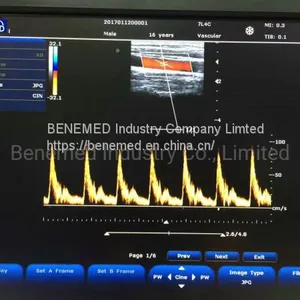 Popular Portable Color Doppler Ultrasound Scanner Bene-3 thumbnail-5