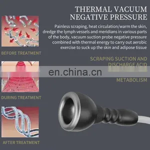 HOT Factory Vacuum Therapy Breast Enlargement Machine Vacuum Pump Butt Lift Breast Sucking Body Therapy Lymph Drainage thumbnail-2