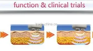 Lift rf Skin Forming Tightening Face Beauty Machine Portable thumbnail-5