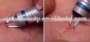 Professional Medical Vascular Removal/Spider Vein Removal Machine 980nm Diode Laser thumbnail-3
