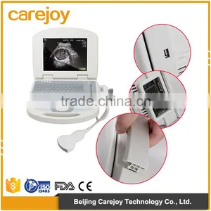 Factory Price Comfortable Application and Professional Software Package Portable Ultrasound Machine for Pregnancy thumbnail-1