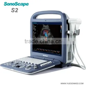 Color Ultrasound Scanner Sonoscape Veterinary Ultrasound thumbnail-3