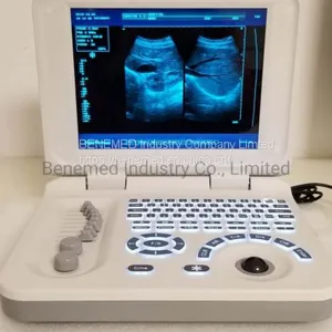 Notebook Type Black and White Ultrasound Scanner Medical Equipment thumbnail-3
