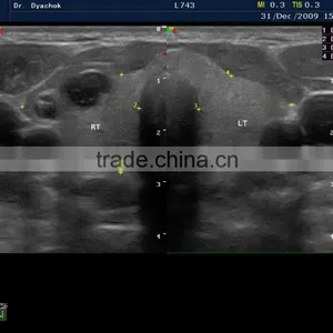 MC-DU-S8EXP Echocardiography Color Doppler Ultrasound Scanner thumbnail-5