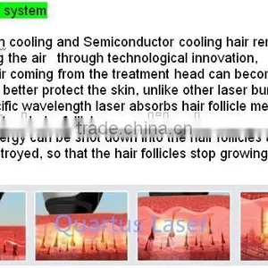Your Own Brand Make up Alexandrite Laser Hair Removal Machine With OEM Designed Languages thumbnail-2