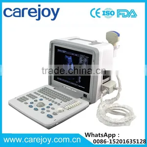 High Performance Low Price Ultrasound Machine thumbnail-1