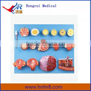 Human Medical Fertilization and Early Embryogeny Anatomical Model thumbnail-1