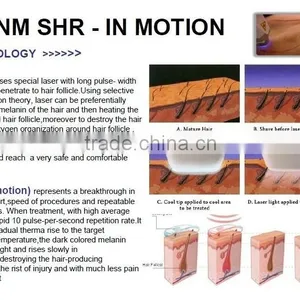 HOT!!!Vertical 808nm Diode Laser Hair Removal Beauty Equipment&machine thumbnail-4