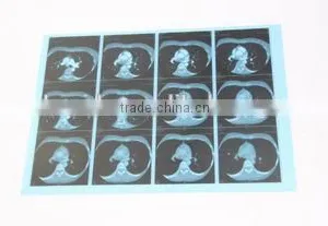 Fuji DI-HL Dry Laser Imaging Film Fuji Film Agfa thumbnail-5