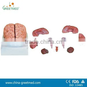 Plastic Medical Human Brain Model With Arteries thumbnail-1