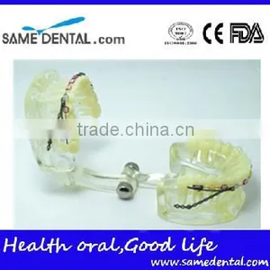 Dental Model Transparent Orthodontic Models Dental Eduction Assitant No. DEA-08 thumbnail-1