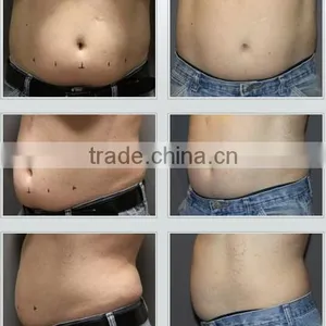 Lose Weight Vertical Weight Loss Loss Weight Cryolipolysis Machine With 2 Cryo Handles thumbnail-6