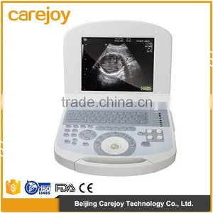CE Approved Health & Medical Equipment 256 Image Scale Portable Laptop Ultrasound Machine thumbnail-1