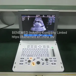 Echo Color Doppler Ultrasound Scanner Bene-5 thumbnail-3