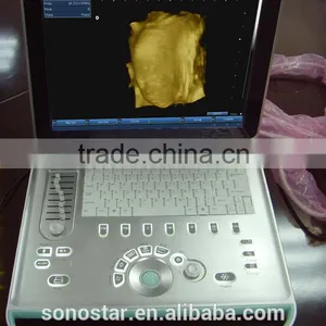 SS-9 PC Based Laptop Ultrasound B Scanner thumbnail-5