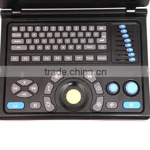 CE Approved Notebook Ultrasound Scanner With 3.5Mhz Multi-frequency Convex Probe RUS-9000E2 thumbnail-3