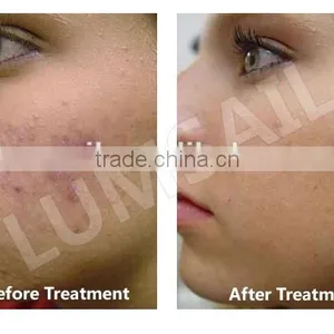 Laser Treatment Unit Photon BIO LED Light Therapy Machine PDT Red+ Blue +Infrared Light Therapy thumbnail-5