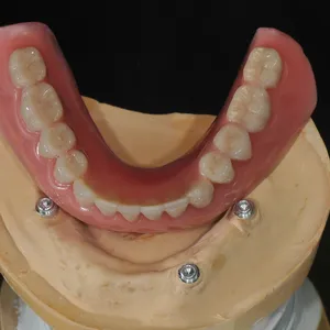 Noritake Zirconia China Dental Lab thumbnail-1