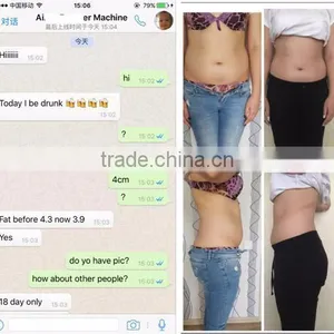 Cellulite Reduction Professtional Fat Freezing Slimming !!!! Body Reshape Rf Cavitation Cryolipolysis Fat Freeze Liposuction Machine thumbnail-2