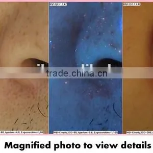 2014 Latest Magic Mirror System Skin Analyzer Equipment thumbnail-4