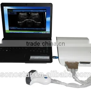 UBox-10 Ultrasound B Scanner Box thumbnail-4
