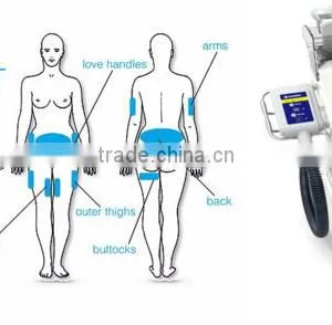 CE Cool Body Sculpting Body Slimming Machine thumbnail-2