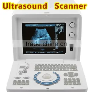 Good Image Ultrasound Machine With Linear Transvaginal Convex Microconvex Rectal Probe thumbnail-1
