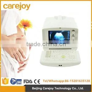 2016 New Digital Portable Ultrasound Scanner Good Quality Low Price thumbnail-1