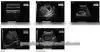 MCB-8500 High Definition Black and White Ultrasound Machine Best Price for Portable Echographe Doppler Mindray thumbnail-4