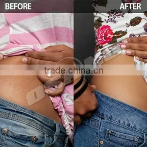 Body Slimming Supplier Of Cryolipolysis Beauty Device 3d Lipo Machine For Sale Zeltiq thumbnail-6