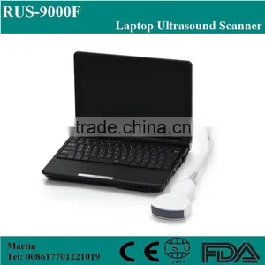 Cheap Medical Portable Ultrasound Machine, Mini Laptop Ultrasound Scanner thumbnail-1