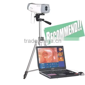 Highly Recommend Electronic Colposcope With CCD Sony Camera 800,000 Pixels With Analysis Software RCS-400 Model thumbnail-1