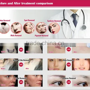 High Quality Professional Tattoo Removal Q-switch Laser thumbnail-6