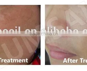 Face Mask Led the Lamp Facial Muscle Stimulator Red Light Therapy Beauty Equipment thumbnail-5