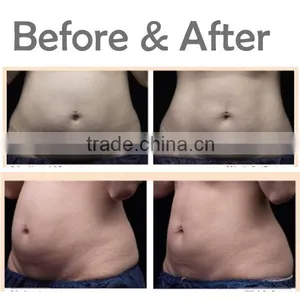 2016 Effective Weight Loss Body Shaping 8mm 13mm HIFU Body Slimming Machine thumbnail-5