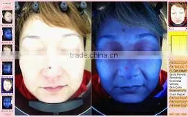 Magic Mirror Skin Analyzer Care Product Personal Care Beauty Salon Product SA 03 thumbnail-3