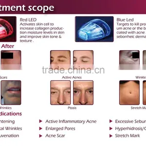 Easy to Delegates Microneedle Fractional rf Machine Radio Frequency Facial thumbnail-5