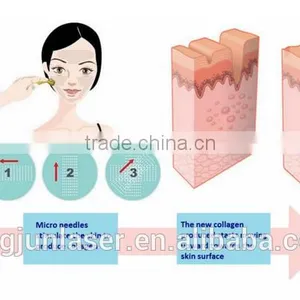 Proffesional 540 Needles Stainess Steel and Titanium Derma Roller thumbnail-6