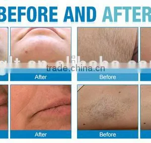 Sapphire Laser Diode 808nm Machine Painless for Permanent Hair Removal thumbnail-5