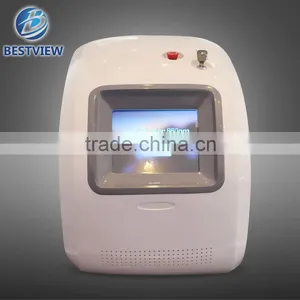 Best Treatment Result Machine Spider Vain Removal With Long Working Time thumbnail-3