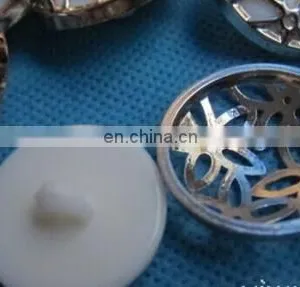 ELECTROPLATED WOMEN CLOTHES BUTTONS TWO SORTS OF BUTTON FASHION NET FLOWER BUTTON thumbnail-6