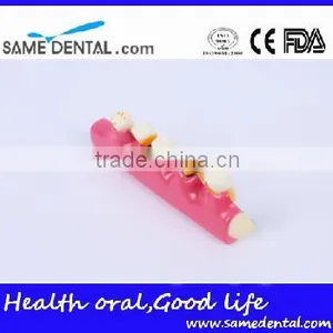 2x Periodontal Disease Classification Models Dental Eduction Assitant No. DEA-20 thumbnail-2