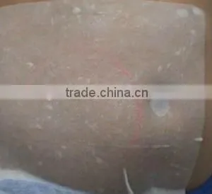 Cryotherapy Anti Freeze Membrane thumbnail-5