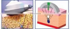 Permanent Body Slimming Ultrashape/Best Slimming Machine Ultrashape/High Quality Ultrashap Machine for Salon thumbnail-5