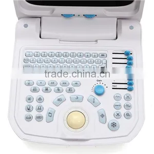 Beautiful Compact Diagnostic Ultrasound Probe / Mini Ultrasound Machine / Portable Ultrasound Scanner thumbnail-5