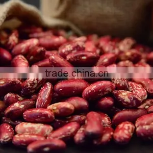 Common Cultivation Style Red Speckled Kidney Beans thumbnail-1