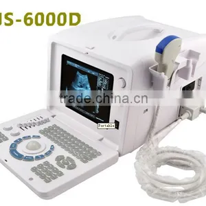 Cheapest Digital Portable Ultrasound Scanner RUS-6000D thumbnail-1