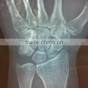 Medical Thermal x Ray Film,agfa Hns Film,Pet Clinic,medical Supplier,agfa Film Dt2b thumbnail-1